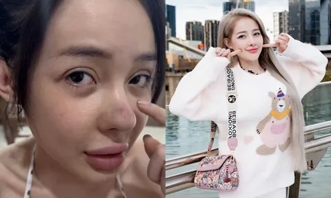Sau 12 lần phẫu thuật thẩm mỹ rồi bị co rút mũi, Ngân 98 lại tiếp tục "gặp biến" khiến dân tình tá hoả