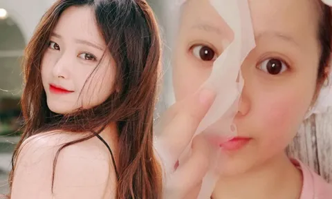 Thứ bán đầy ngoài chợ hóa ra là “vựa” chất chống oxy hóa, lấy vỏ đem đắp mặt cũng giúp da căng bóng, là phẳng nếp nhăn