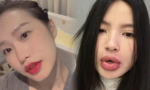 Các nàng WAGS nô nức thẩm mỹ, làm đẹp cận Tết, bà xã Đoàn Văn Hậu thừa nhận "liều lĩnh" vì một điều